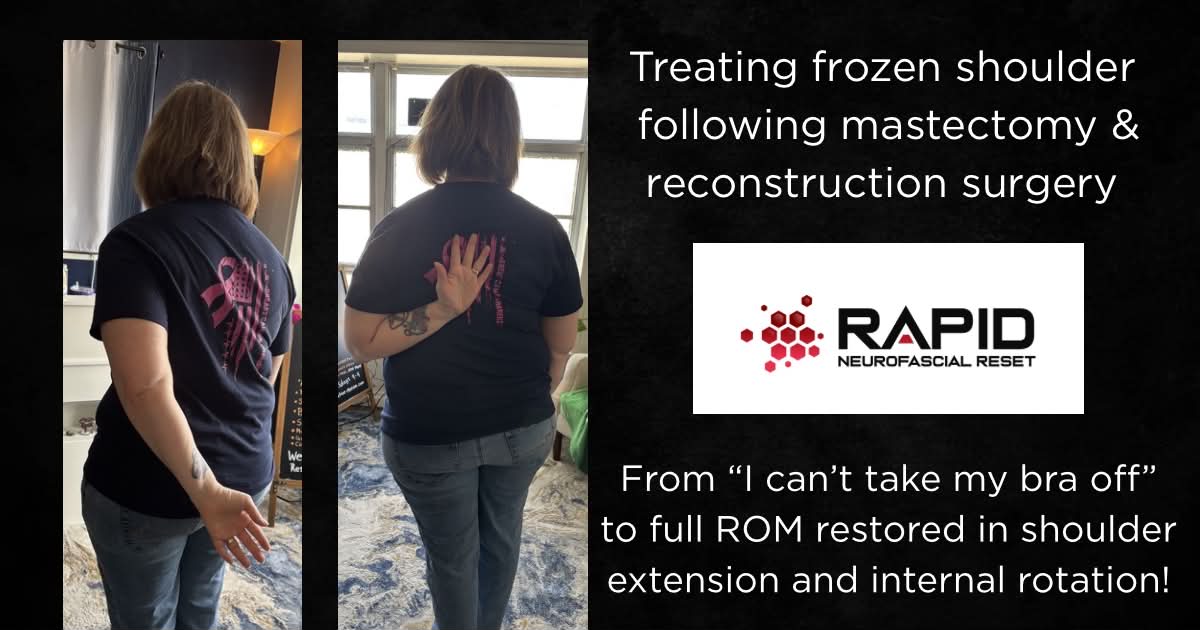 Rapid NFR Frozen Shoulder